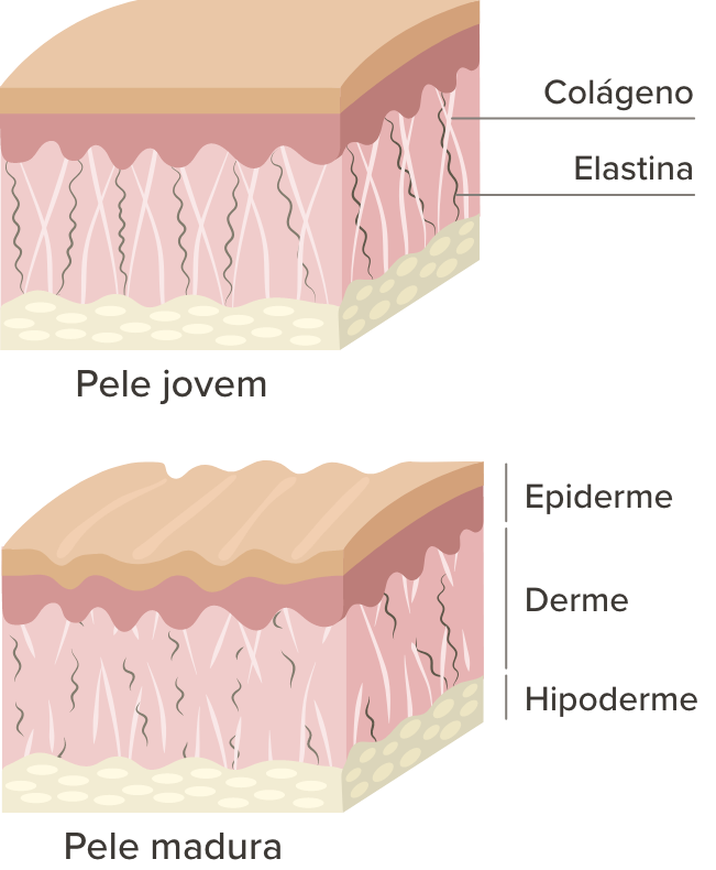 Imagem comparando as camadas de uma pele jovem e uma pele madura para explicar os efeitos do colágeno e da elastina. Imagem comparando as camadas de uma pele jovem e uma pele madura para explicar os efeitos do colágeno e da elastina.