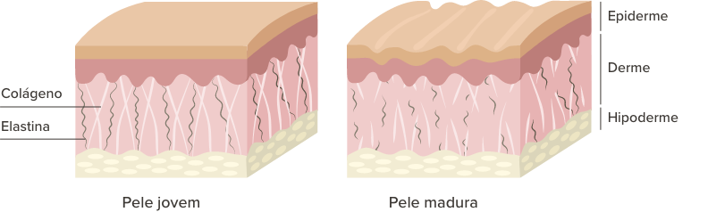 Imagem comparando as camadas de uma pele jovem e uma pele madura para explicar os efeitos do colágeno e da elastina. Imagem comparando as camadas de uma pele jovem e uma pele madura para explicar os efeitos do colágeno e da elastina.